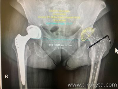 урси по ендопротезуванню колінного та кульшового суглоба у Словенії урси по ендопротезуванню колінного та кульшового суглоба у Словенії