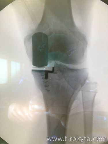 Курси з хірургії коліна